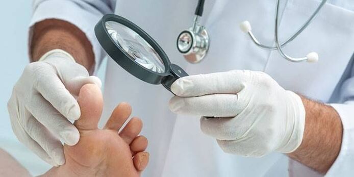 Il medico esamina il piede di un paziente con una punta con una lente d'ingrandimento