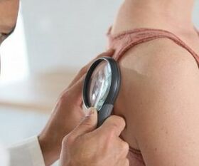 Come determinare il virus del papilloma umano