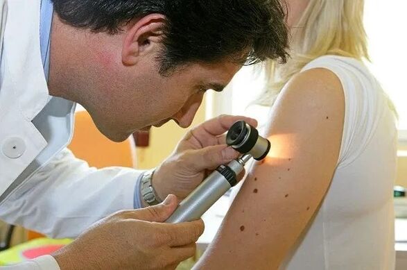 diagnosi di papillomi