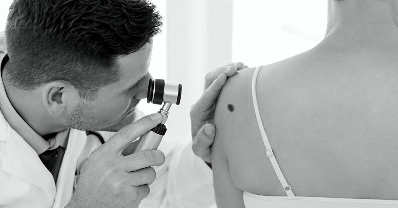 uno specialista diagnostica il tipo di verruca