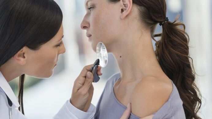 il medico determina il tipo di papilloma sul collo